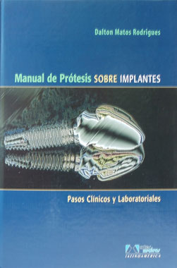 Manual de Protesis Sobre Implantes