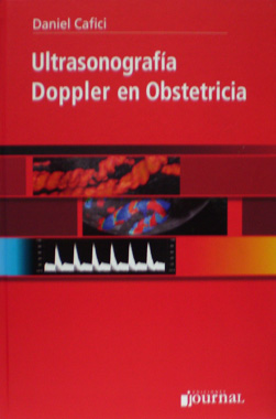 Ultrasonografia Doppler en Obstetricia