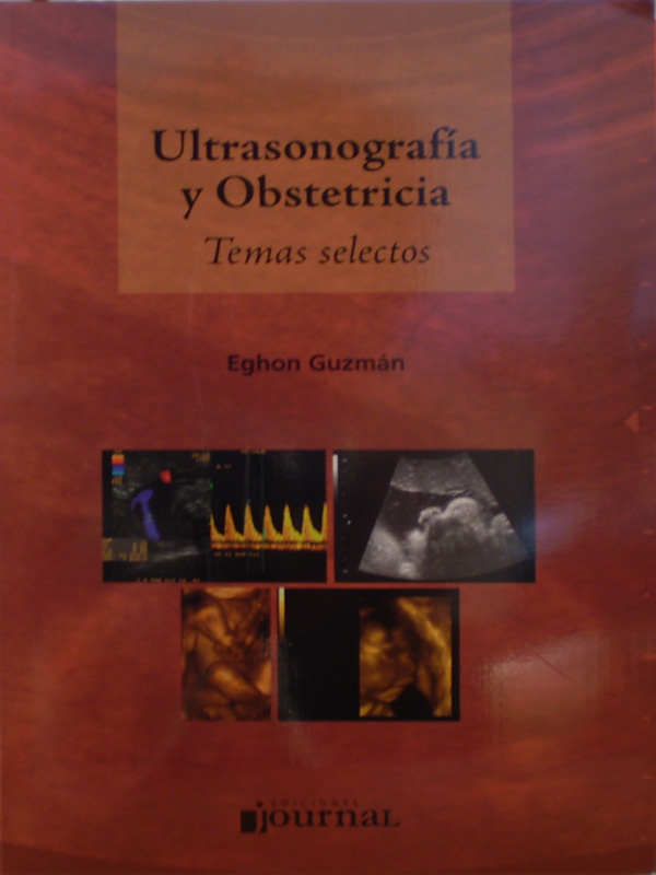 Libro: Ultrasonografia y Obstetricia Temas Selectos Autor: Eghon Guzman