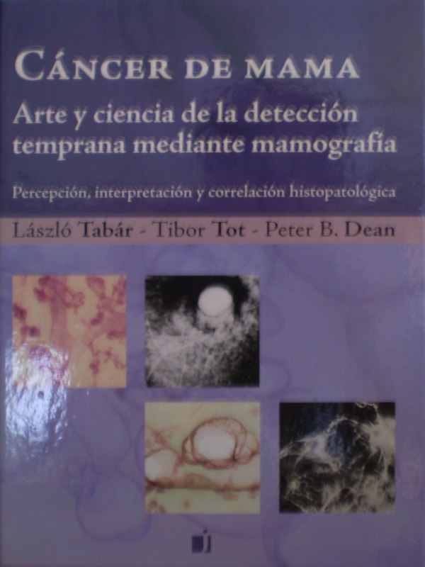 Libro: Cancer de Mama Arte y Ciencia de la Deteccion Temprana Mediante Mamografia Autor: Laszlo Tabar