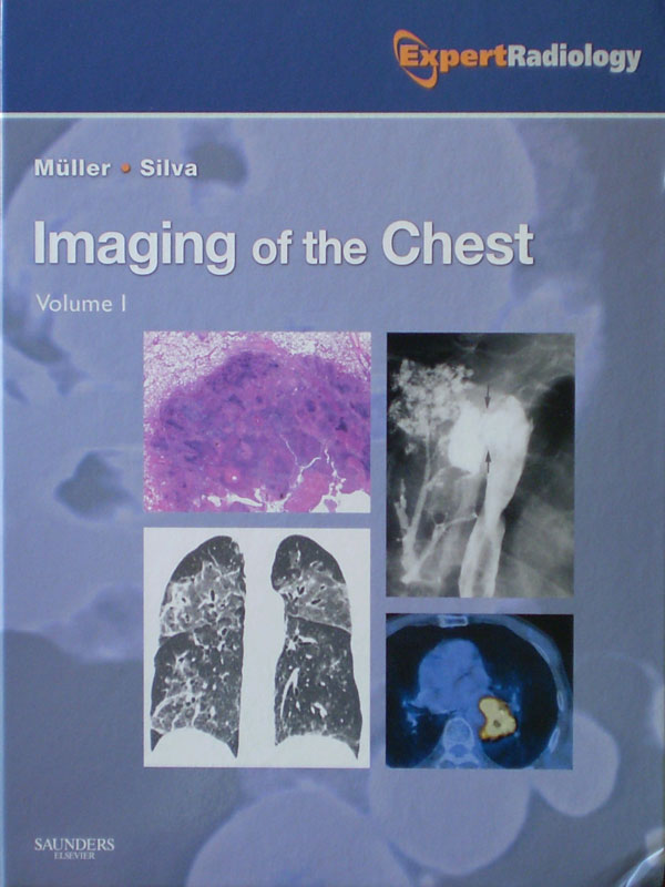 Libro: Imaging of the Chest 2 Volumenes Set Expert Radiology Autor: Muller