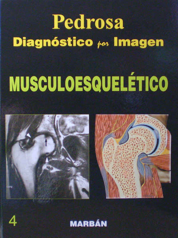 Libro: Diagnostico por Imagen Musculoesqueletico T.D. Autor: Pedrosa 4