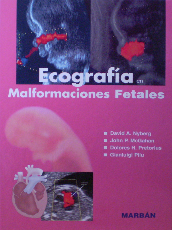 Libro: Ecografia en Malformaciones Fetales T.D. Autor: David A. Nyberg