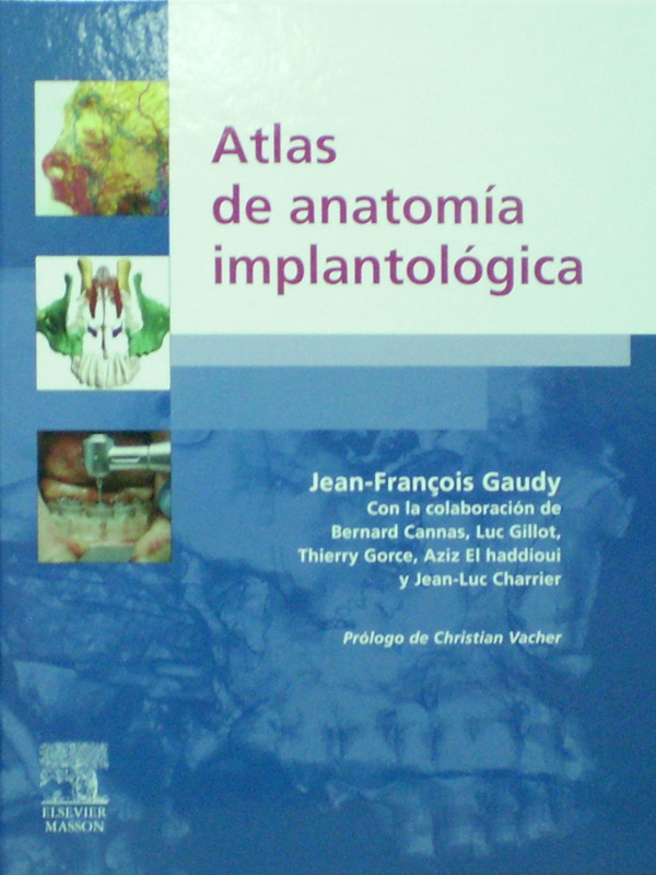 Libro: Atlas de Anatomia Implantologica Autor: Jean-Francois Gaudy