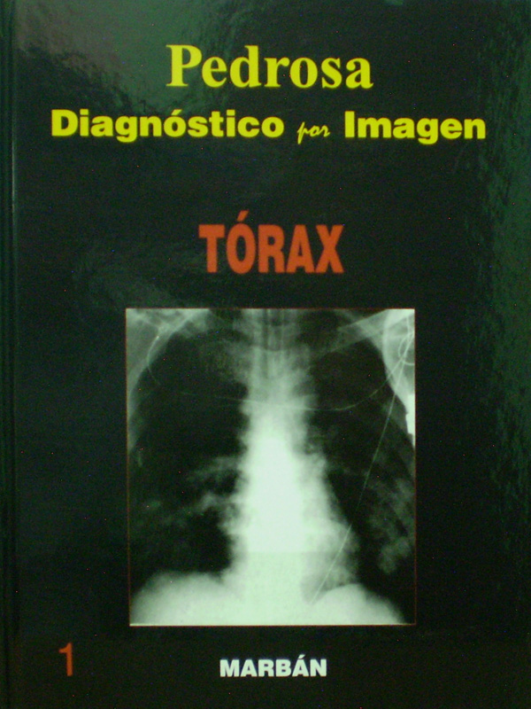 Libro: Diagnostico por Imagen Torax Flexilibro Autor: Pedrosa 1