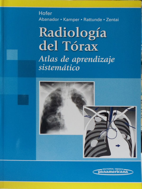 Libro: Radiología del Torax, Atlas de Aprendizaje Sistematico Autor: Hofer, Abanador, Kamper, Rattunde, Zentai