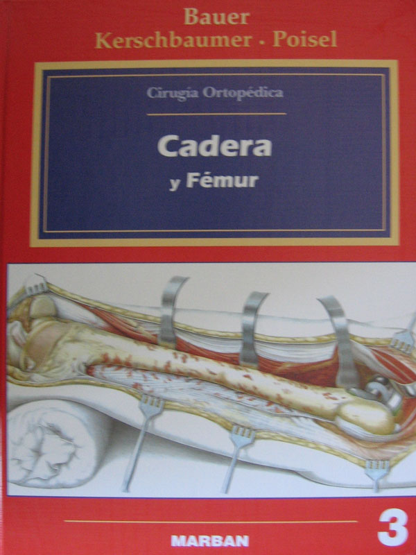 Libro: Cadera y Femur  (Cirugia Ortopedica) Autor: Bauer 3