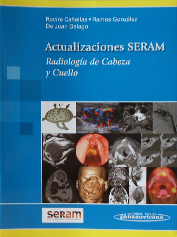 Libro: Actualizacion SERAM, Radiologia de Cabeza y Cuello Autor: Rovira Cañellas, Ramos Gonzales, De Juan Delgado