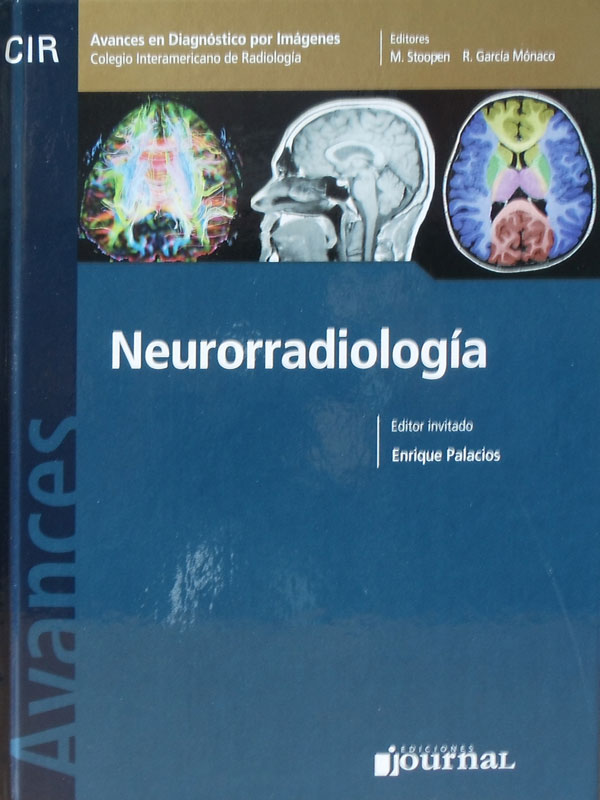 Libro: Avances en Diagnostico por Imagenes Neurorradiologia Autor: M. Stoopen, R. Garcia Monaco