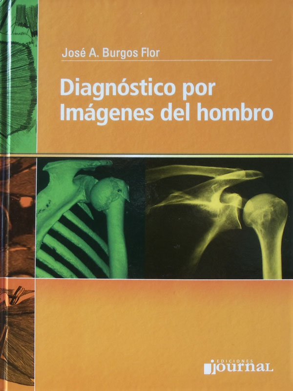 Libro: Diagnostico por Imagenes del Hombro Autor: Jose A. Burgos Flor