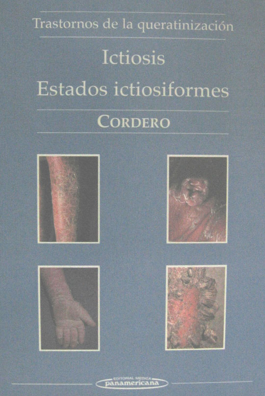 Libro: Ictiosis Autor: Cordero