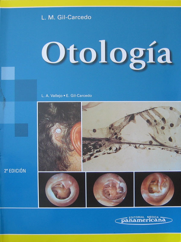 Libro: Otologia, 2a. Edicion Autor: L. A. Vallejo, E. Gil-Carcedo