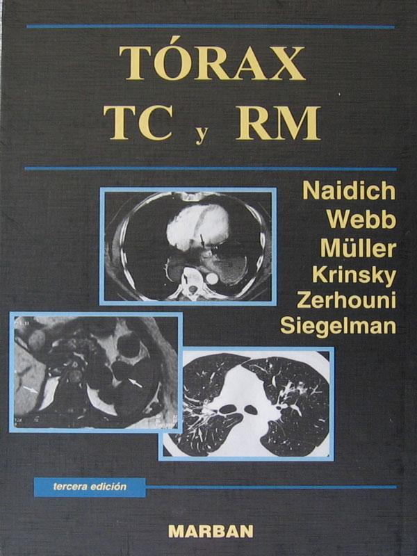 Libro: Torax TC y RM. 3a. Edicion. Autor: Naidich, Webb, Muller, Krinsky, Zerhouni, Siegelman