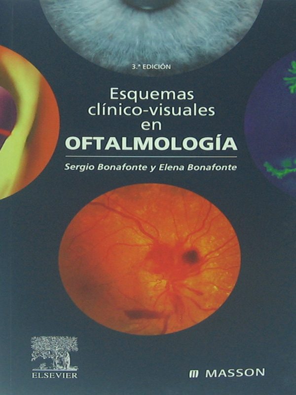 Libro: Esquemas Clinico-Visuales en Oftalmologia, 3a. Edicion Autor: Sergio Bonafonte, Elena Bonafonte