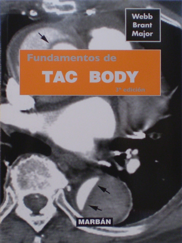 Libro: TAC Body de Bolsillo 3a. Edicion Autor: Webb